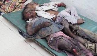 21.04.2015 - Yémen : l'Arabie Saoudite utilise des gaz toxiques tuant des dizaines d'enfants