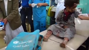 09.08.2018 -La voyoucratie saoudienne attaque le Yémen : 39 écoliers massacrés