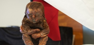 22.06.2015 - Enfant de Detmold : 6.500 ans plus tard, le diagnostic est tombé
