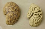 19.03.2016 - Alzheimer : des scientifiques espèrent réactiver la mémoire