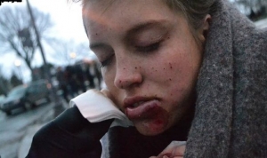 28.03.2015 - Manifestation contre les mesures d'austérité: une jeune femme blessée au visage