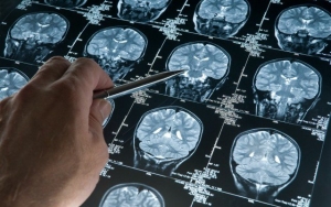 17.02.2016 - Un neuroscientifique montre ce que le jeûne fait pour votre cerveau et pourquoi big pharma ne va pas l’étudier